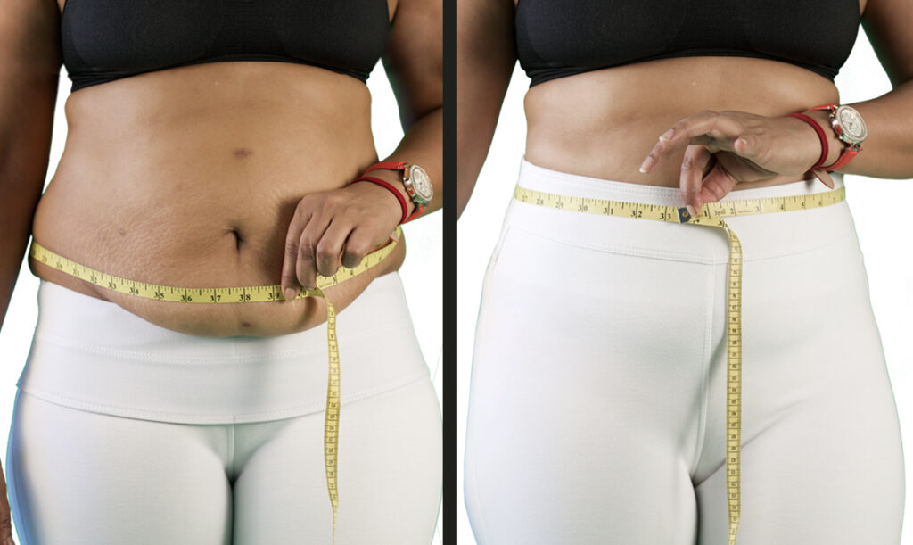 shapewear effect before and after